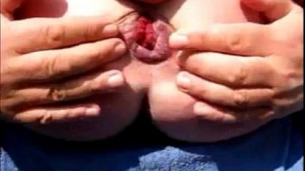 Bi Men Nudist Extrem Monster Asshole rosebud bizzare fetisch Analvotze Arschloch  