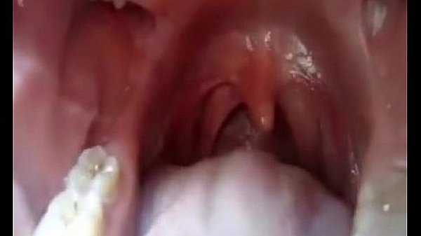 The inside of the mouth