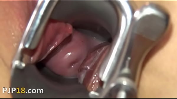 Camera deeply in her gaped vagina vagina  