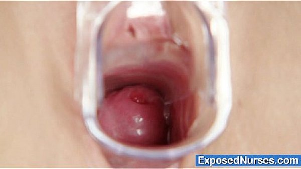 Redhead nurse Samantha pussy gaping on gynochair