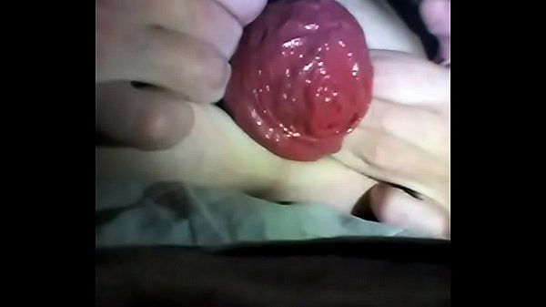 Anal Prolapse