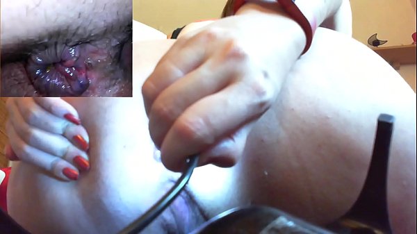 Hardcore anal session with a medical endoscope a super medical fetish video  