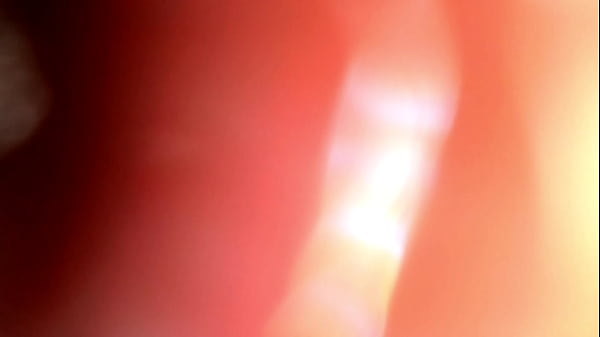 small cock peehole  scope  