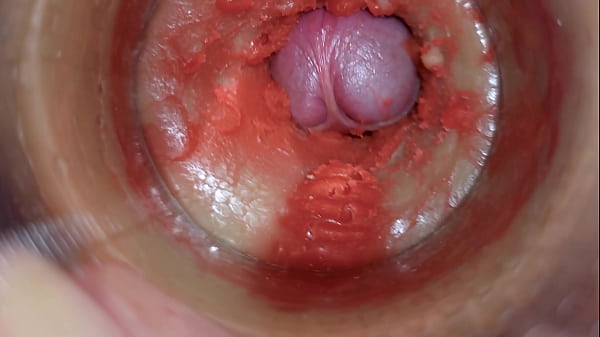 Camera Inside Deep Pussy Captures Huge Ejaculation of Sperm 4k