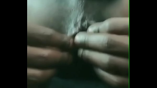 Permanent Protruding Black Asshole From Getting Slutted Out (Anal Retardation #301) 