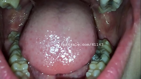 Misha Mouth Video3 Preview