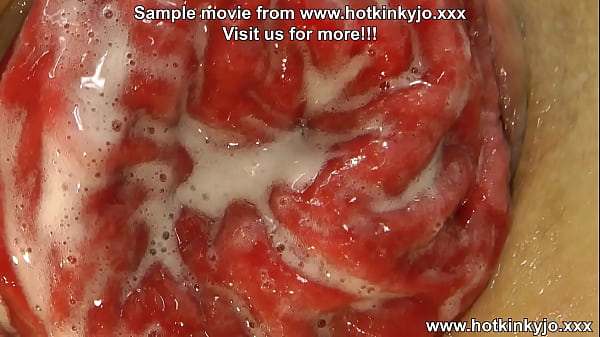 HKJ anal fisting, gape & prolapse 15.01.2024 