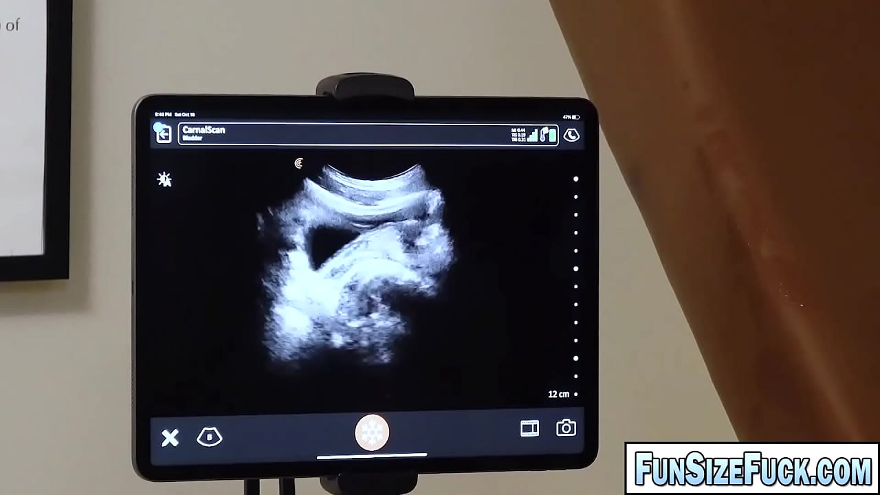 Dr Legrand Wolf use his dick to check Tom