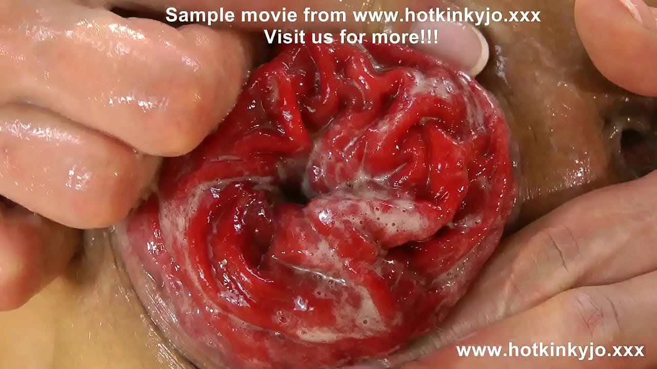 HKJ fis her ass and push her prolapse out