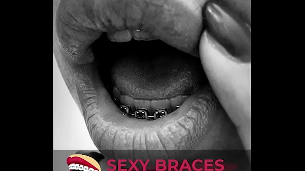 Sexy Girls Having Braces Compilation