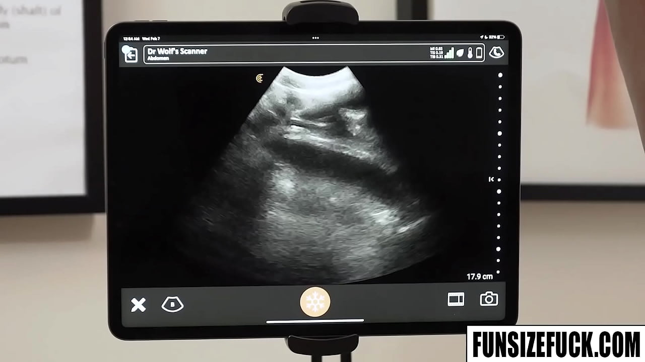 Noah White submits to doctor Legrand Wolf showing like a champ