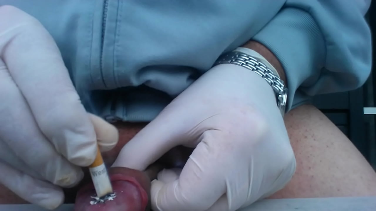 videocompress-086-sigaretta spenta sul glande