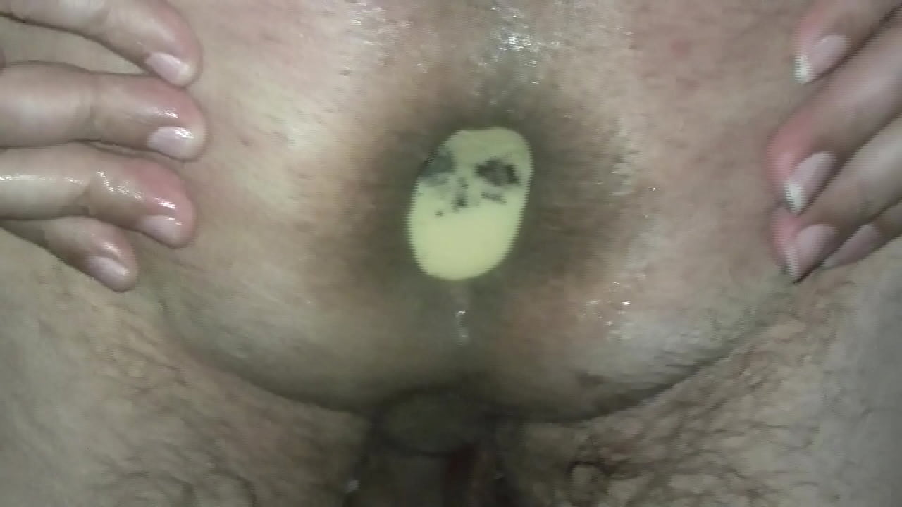 practicando con mi orto