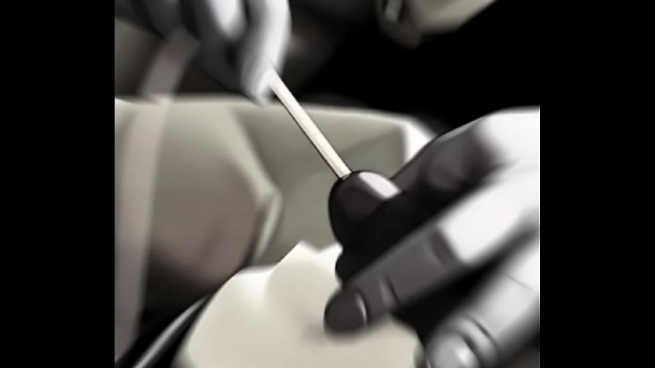 女医による男性患者へのカテーテル挿入