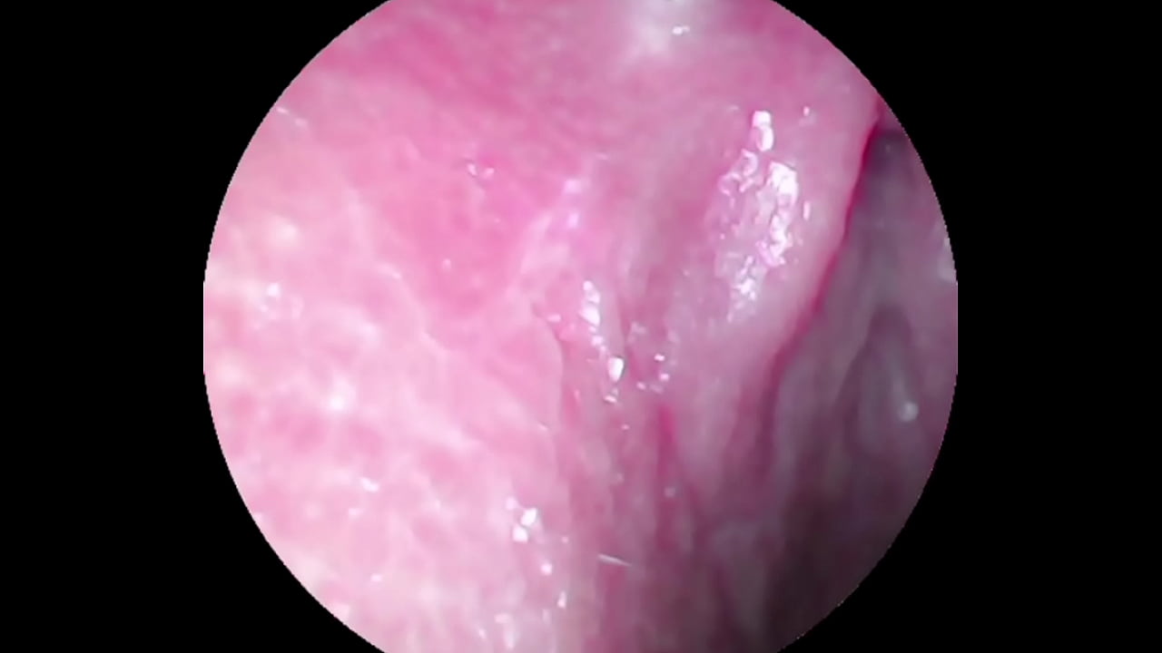 Camera deep inside of the wet pussy and captured the intense female orgasm!!