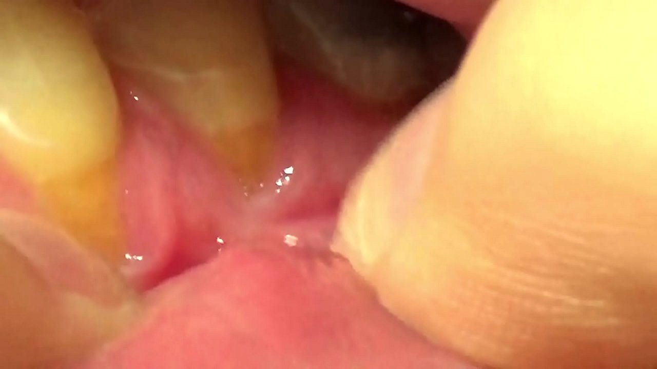 Brunette Shows Off Her Teeth and Fillings