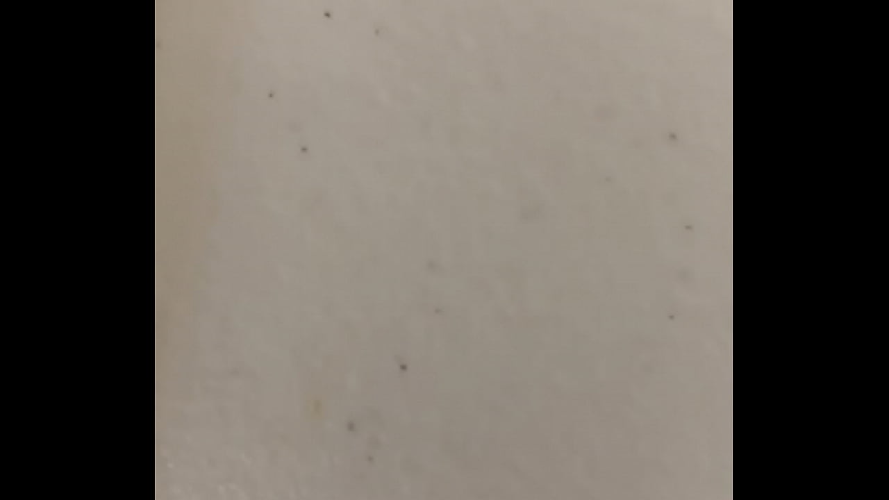 Chronic masterbation