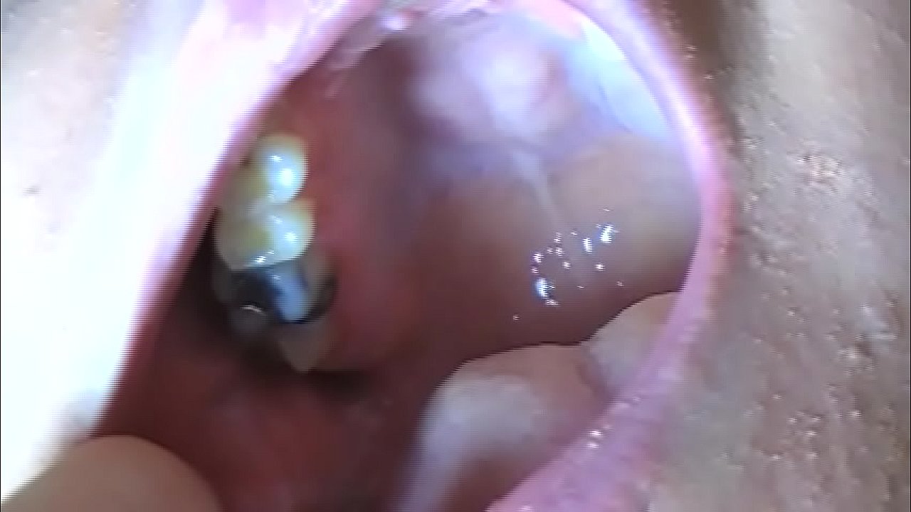 Fifi Foxx Shows Off Fucked Up Teeth