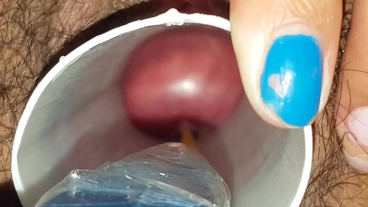 Fucking bogotan cervix 3