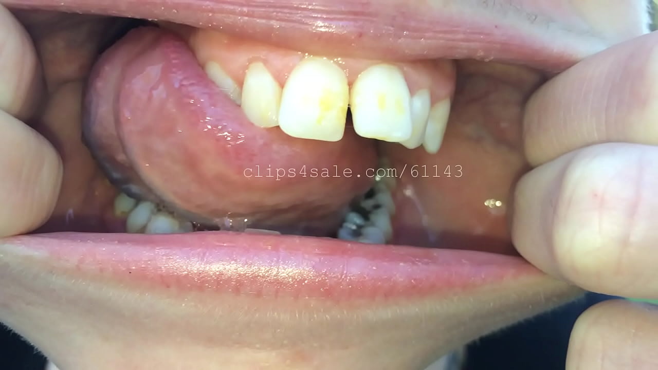 Mouth (Annie) Video 2 Preview