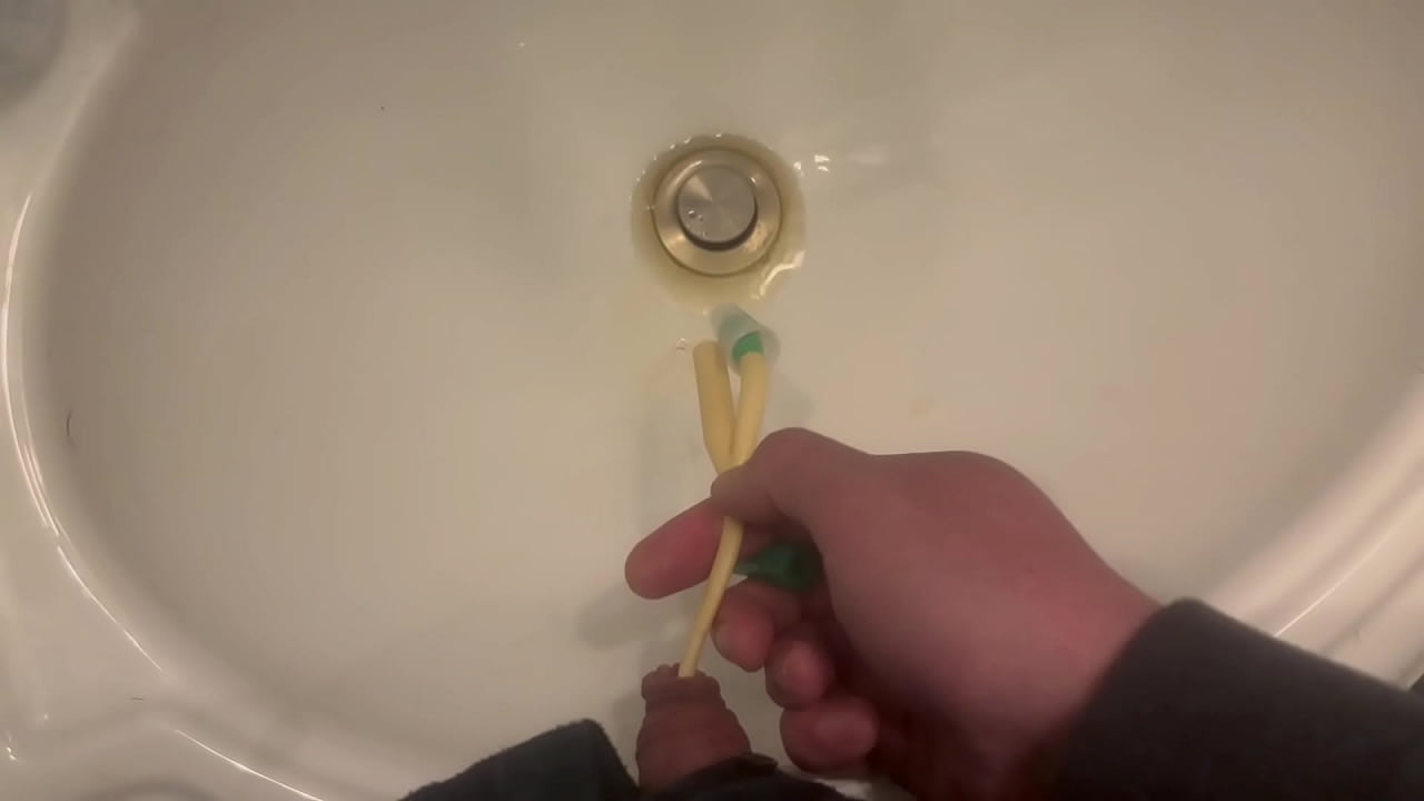 Bladder Release Through Catheter