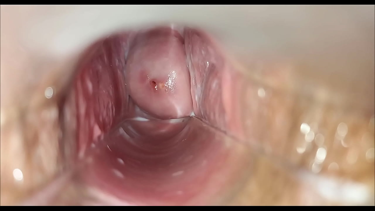 orgasm speculum