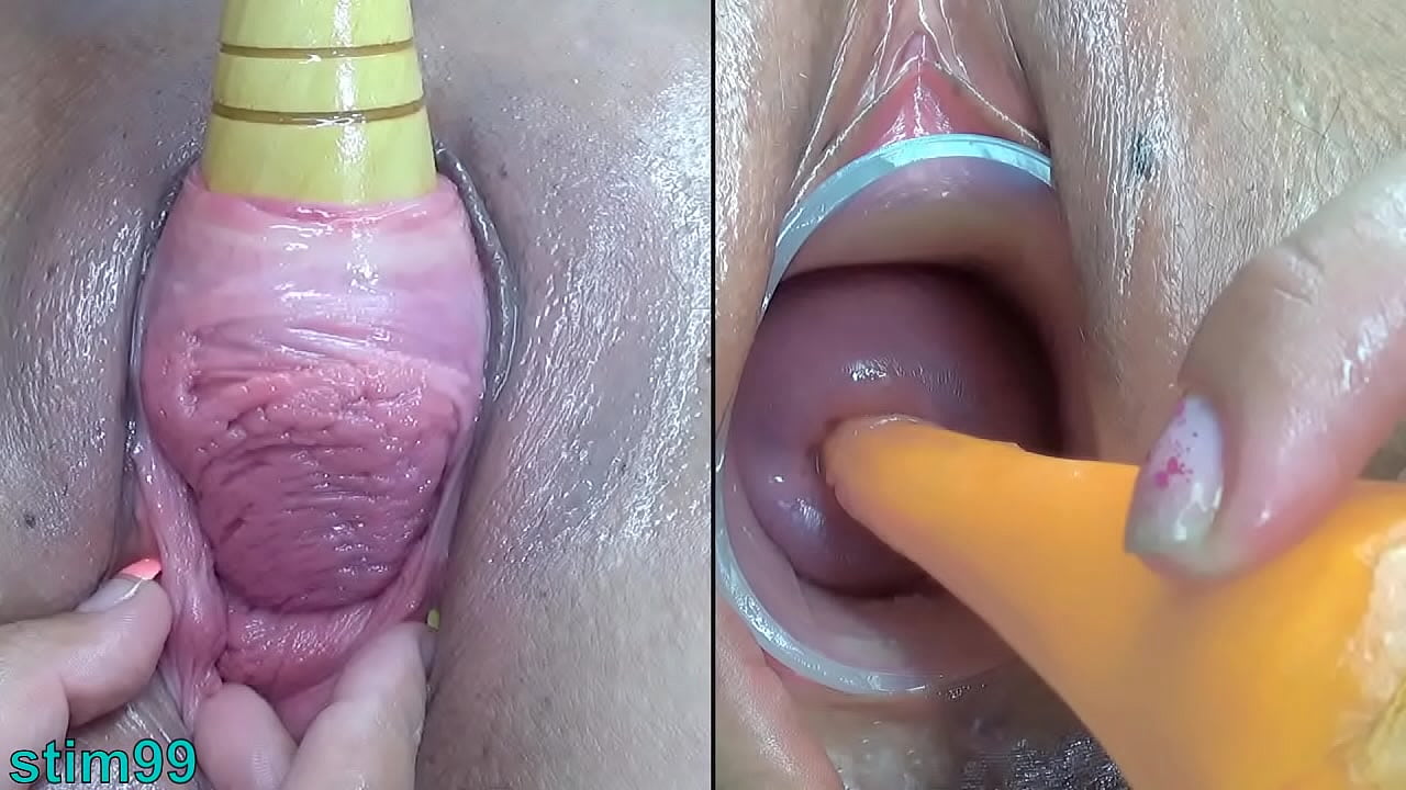 Mature Lesbians Pee hole Insertion and Cervix Fucking one to other Uncensored urethral sounding