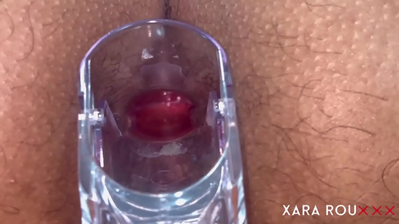 Anal Vision Speculum