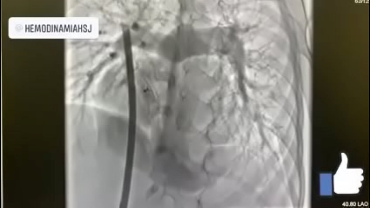 Aguascalientes M&eacute;xico