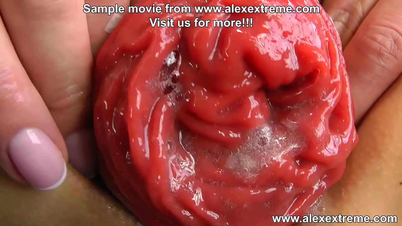 bottle, anal gape & prolapse HKJ