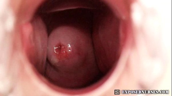 Nurse Zaneta speculum masturbation at clinic