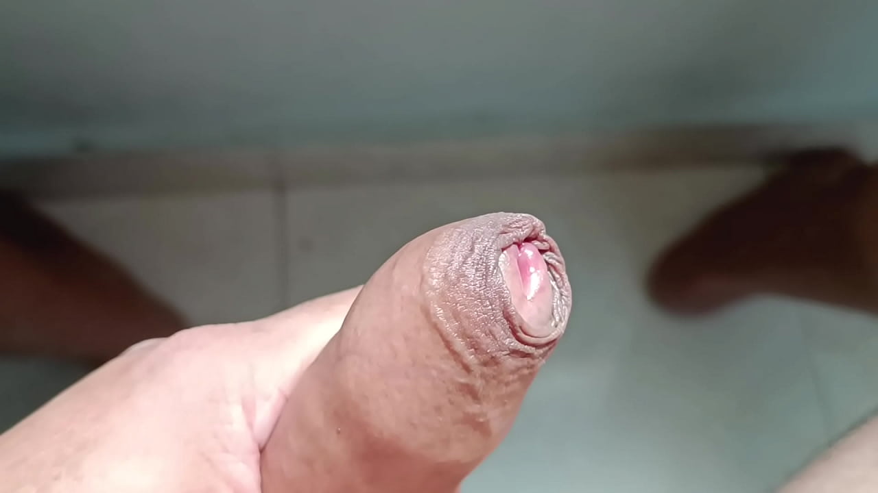 Hago retractil mi prepucio