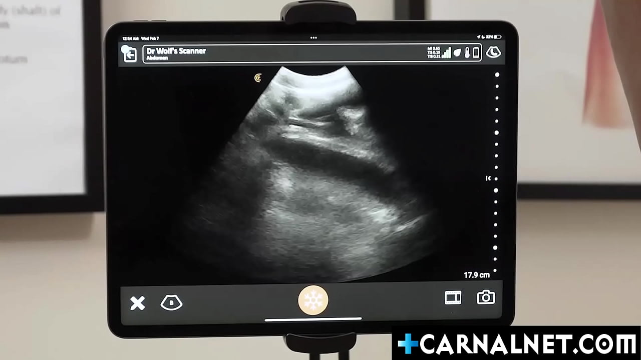 Twink Noah White getting another anal ultrasound from doctor LEgrand WOlf