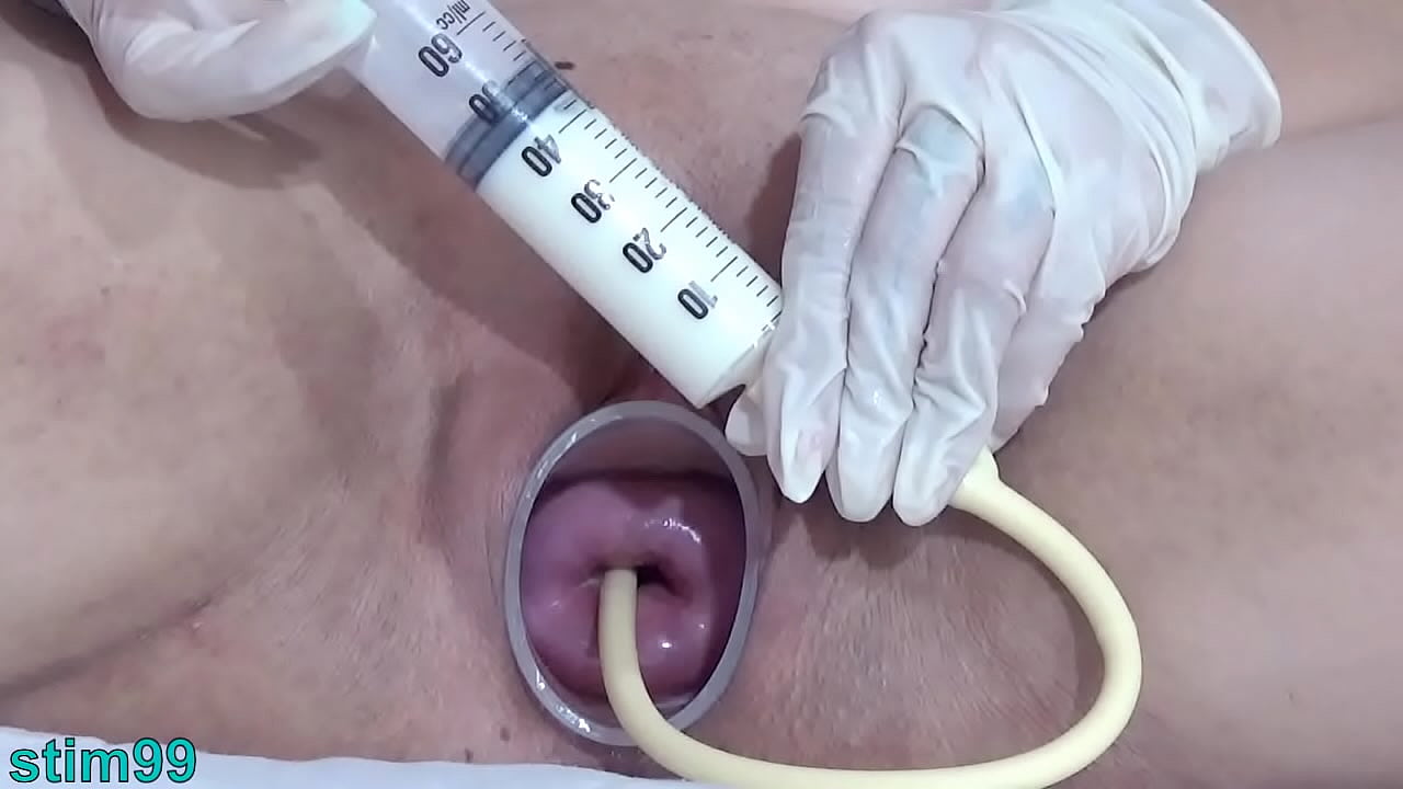 Perverse mature enlarge her cervix with penetration of catheter inflated until orgasm