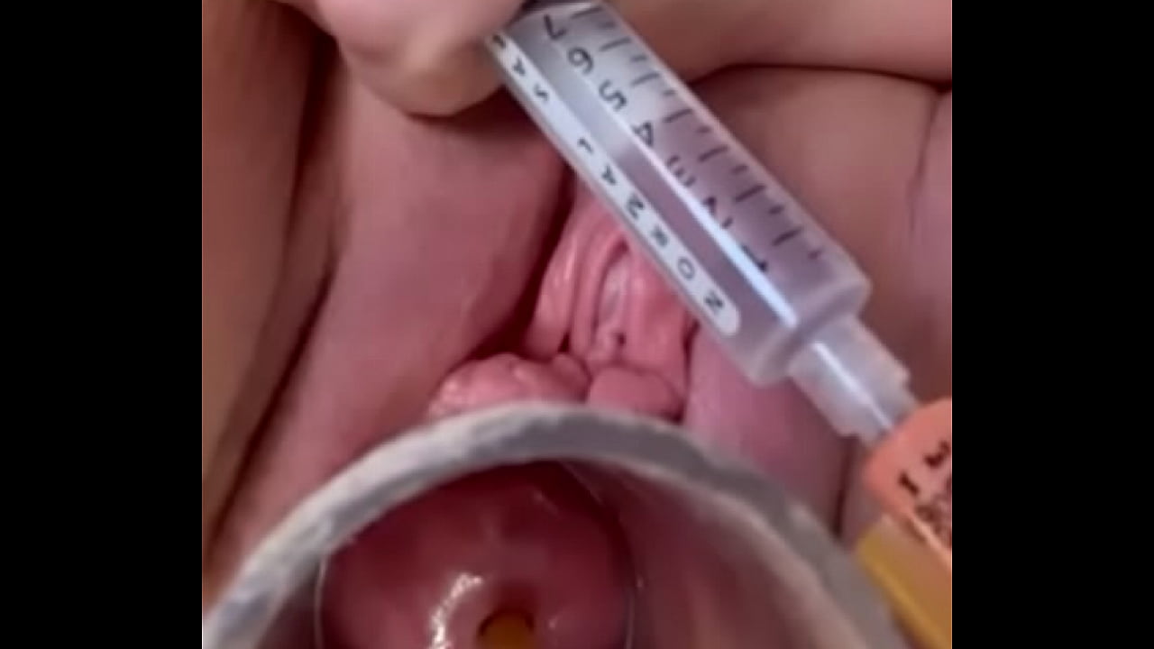 Advancing cervical catheter