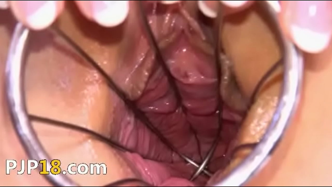 Gap her gyno pussy really hard