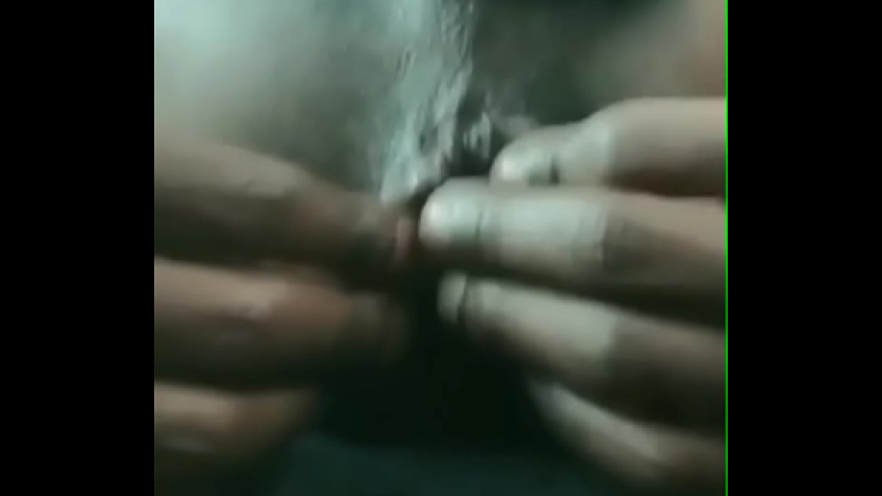 Permanent Protruding Black Asshole From Getting Slutted Out (Anal Retardation #301)