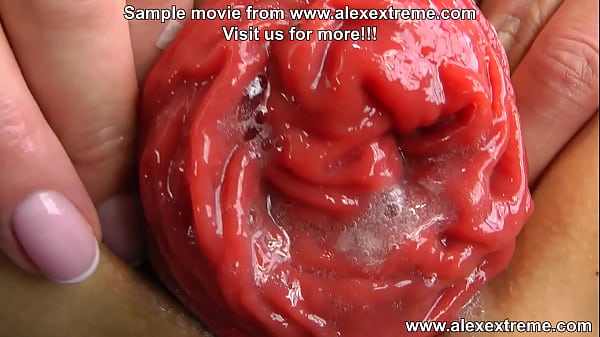 bottle, anal gape & prolapse HKJ