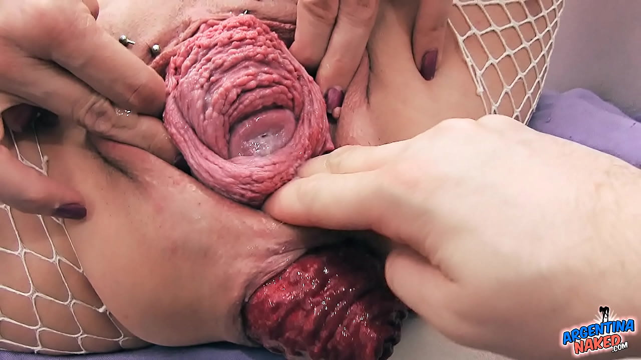 Most Incredible Prolapse Scene! Cervix, Fisting, Max Stretch