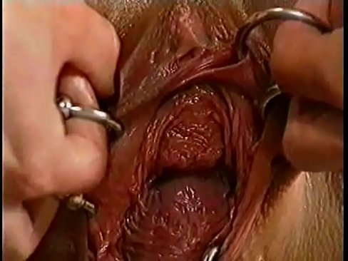 Monster Vagina. Extreme piercing. Fisting