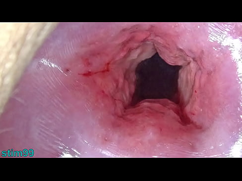 Japan Mom Cervix open wide Dilatation and fucking Uterus with Insertion of huge Objects