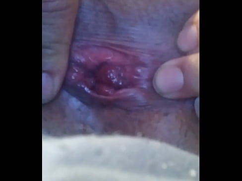 Had boy half girl