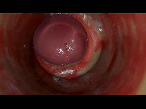 Camera Inside Deep Pussy Captures Huge Ejaculation of Sperm ASMR
