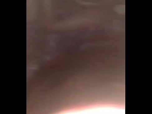313 exposed