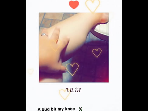 Kiss my booboo better foot fetish cute girl