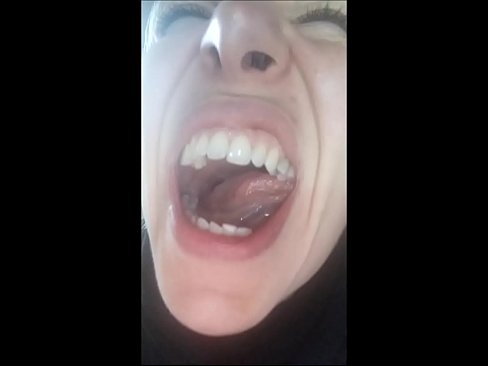 i need a dentist right now!
