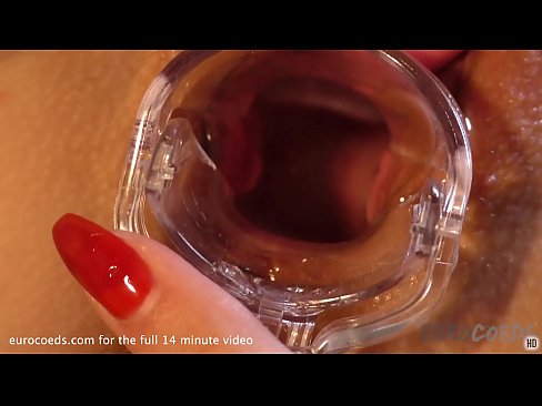blondie creative gyno weird video