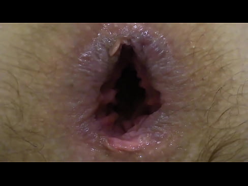 A brunette with a big dildo fucks her anal and stretches the anus and shows beautiful booty in different positions Then she masturbates her hairy cunt  A brunette with a big dildo fucks her anal and stretches the anus and shows beautiful booty in different positions Then she masturbates her hairy cunt