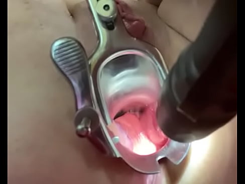 Anal speculum