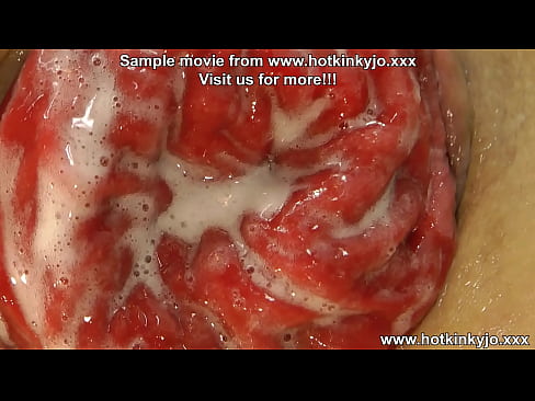HKJ anal fisting, gape & prolapse 15.01.2024